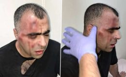 Belediye başkanının korumaları tarafından saldırıya uğramıştı: Gazeteciye saldırganlara ‘hakaret’ten hapis cezası