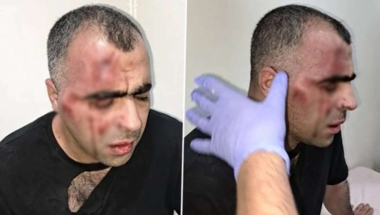 Belediye başkanının korumaları tarafından saldırıya uğramıştı: Gazeteciye saldırganlara ‘hakaret’ten hapis cezası