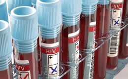 HIV virüsü nedir, belirtileri nelerdir? HIV Enfeksiyonu (AIDS) nasıl bulaşır?