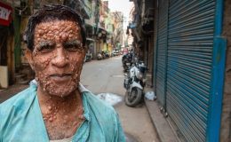 Çoğunun adını hiç duymadınız! Türkiye’de ABD ve Avrupa’dan daha fazla görülüyor