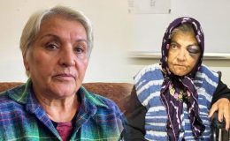 Diyaliz merkezinde skandal iddia: Engelli kadının yüzü tanınmaz hale geldi